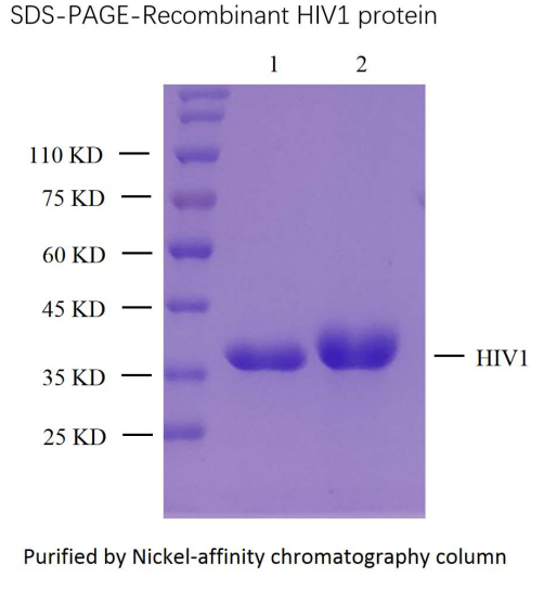 人免疫缺陷病毒1型(HIV1)重组蛋白