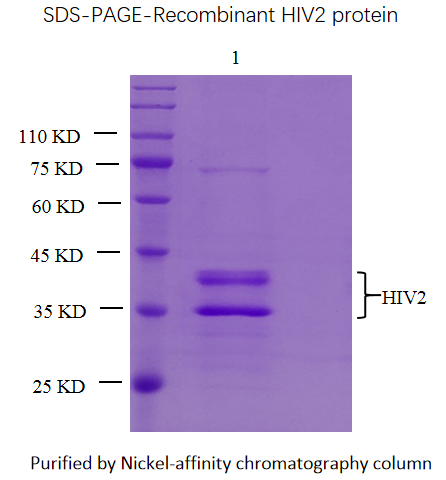 人免疫缺陷病毒1型(HIV1)重组蛋白