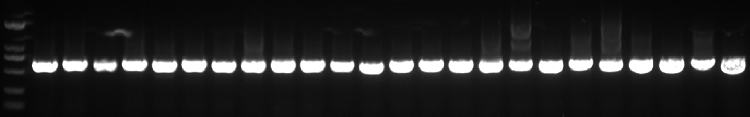 菌液PCR检测
