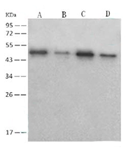 SARS-CoV Nucleoprotein 