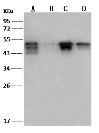 SARS-CoV Nucleoprotein 