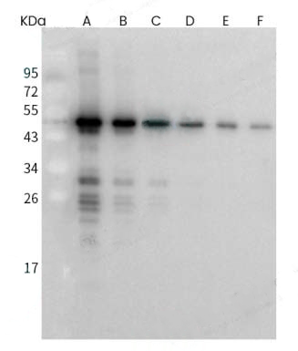 SARS-CoV Nucleoprotein / NP Antibody