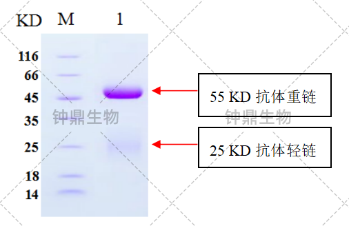 纯化ADA抗体SDS-PAGE分析结果