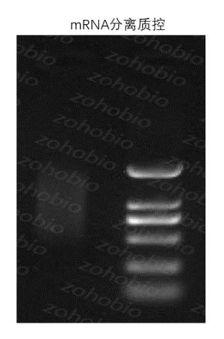 mRNA 富集琼脂糖凝胶电泳成像
