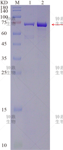蛋白纯化SDS-PAGE分析